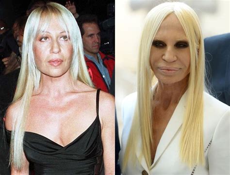 donatella versace surgery|donatella versace without make up.